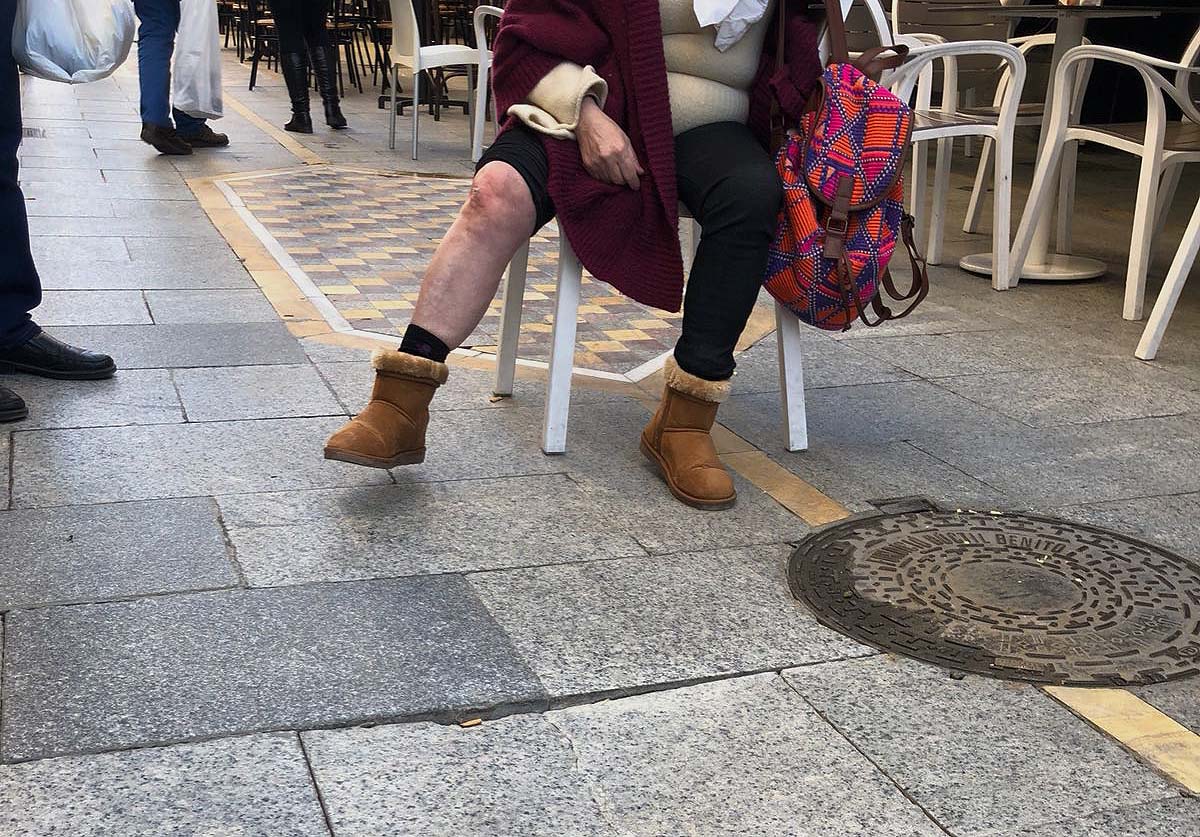 Una mujer muestra las heridas en la rodilla tras caer al tropezar con una baldosa rota y hundida. Foto Luis Pacheco.