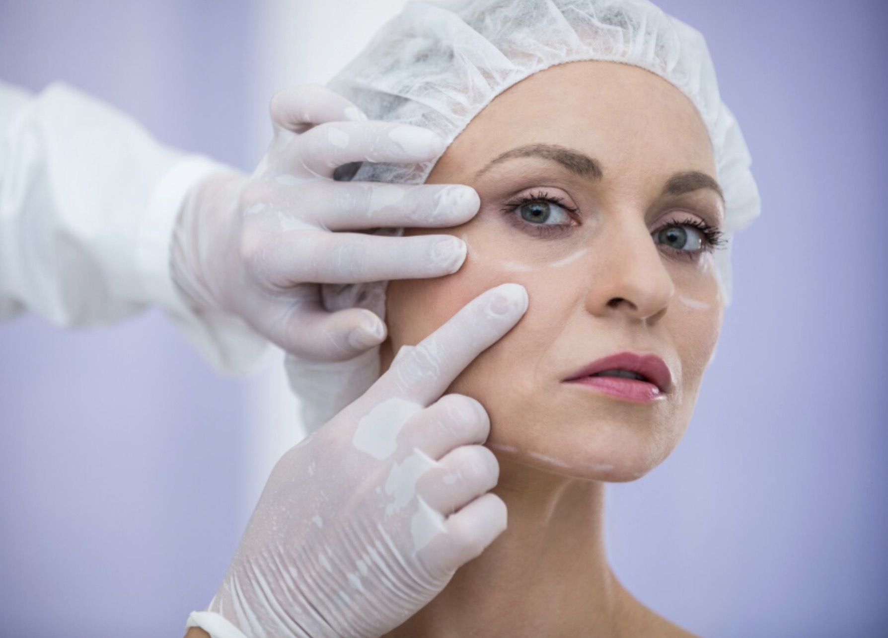 Blefaroplastia en Málaga para una mirada natural